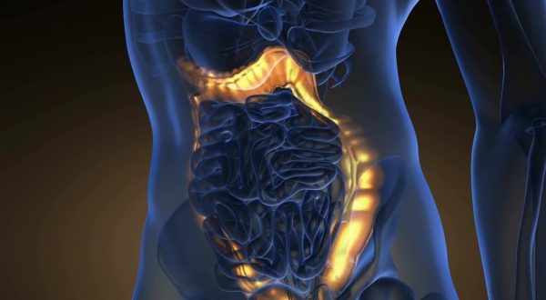 Tumore del colon: microbiota responsabile delle metastasi al fegato