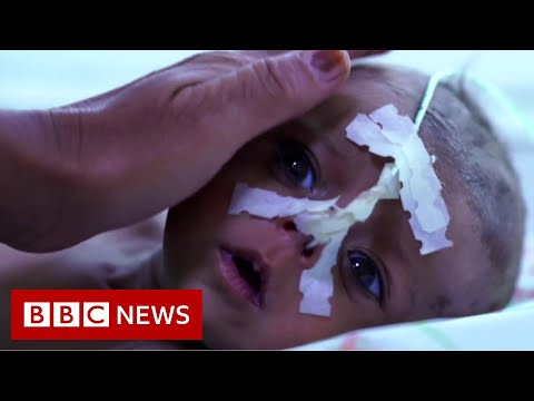 Afghan baby girl sold for $500 by starving family – BBC News