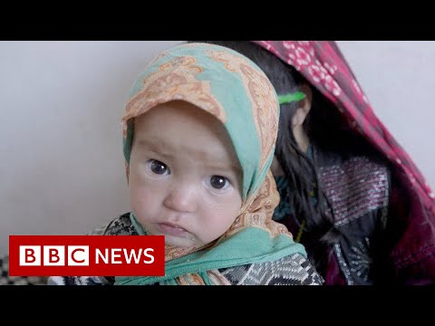 Afghan children battle malnutrition and measles as 23m face extreme hunger – BBC News