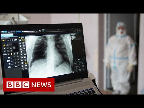 Some long Covid patients may have hidden damage to their lungs – BBC News