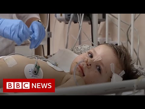 The child victims of Russia’s war in Ukraine – BBC News