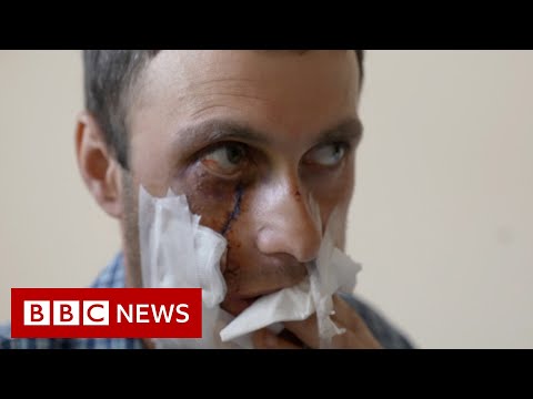 Ukrainians injured and killed by unexploded ammunition – BBC News