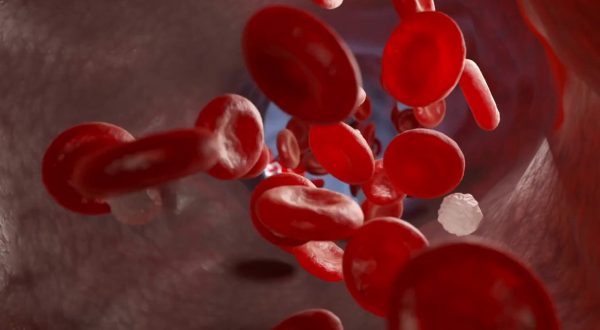 Beta-Talassemia, nuova molecola riduce la necessità di sangue