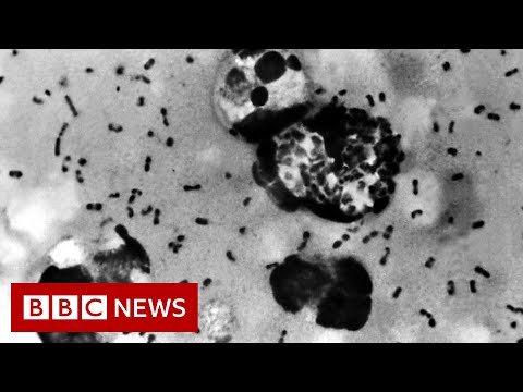 Ancient teeth reveal where Black Death began, researchers say – BBC News