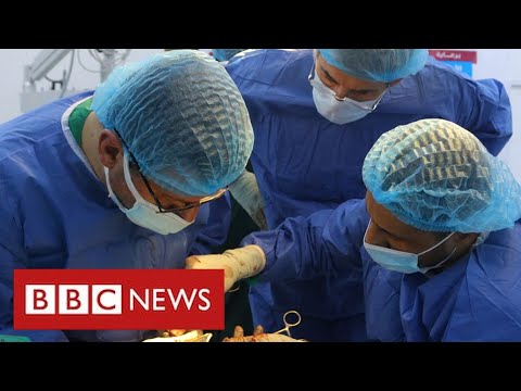 Leading surgeon trains Ukraine’s doctors to treat war injuries – BBC News