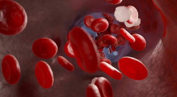 Beta-Talassemia, in Sicilia una rete per il trattamento