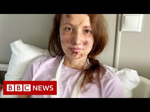 Russian woman rescued from bomb site in Ukraine – BBC News