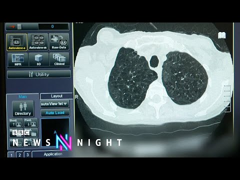 Why is England’s cancer crisis getting worse? – BBC Newsnight