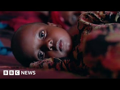 Half a million young children may die in Somalia warns UN – BBC News