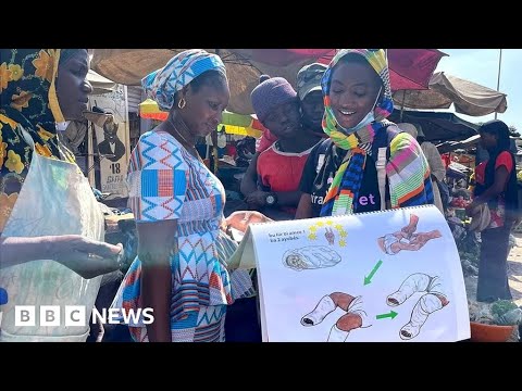 Clubfoot treatment turning lives around in Senegal – BBC News