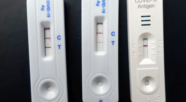 Covid, 29.433 nuovi positivi e 244 decessi nell’ultima settimana