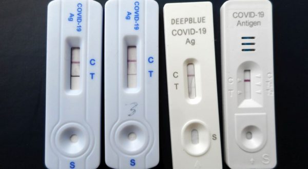 In Sicilia contagi Covid in calo -5,6%, ospedalizzazioni stabili