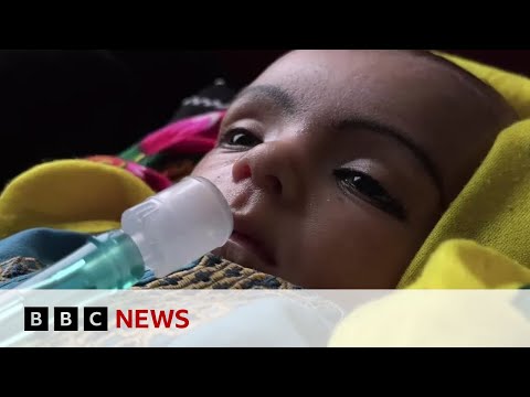 Children in Afghanistan dying from preventable diseases, says charity – BBC News