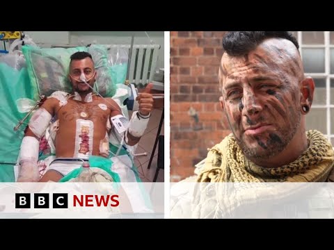 British soldier returns to Ukraine after life-changing injury – BBC News