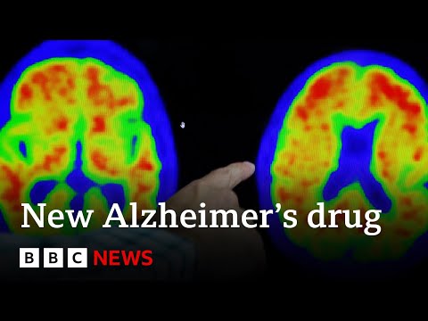 New drug brings hope to end Alzheimer’s – BBC News