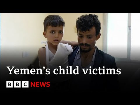 Child victims of Yemen’s civil war – BBC News