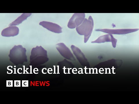 UK approves gene therapy to cure two blood disorders – BBC News