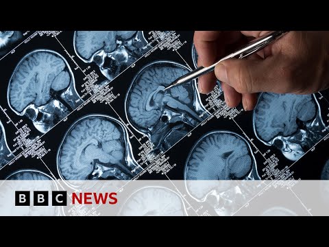 Using virtual reality to diagnose Alzheimer’s disease | BBC News