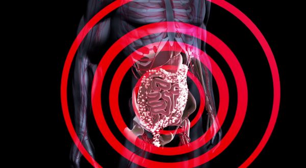 Malattie croniche dell’intestino per 250 mila italiani