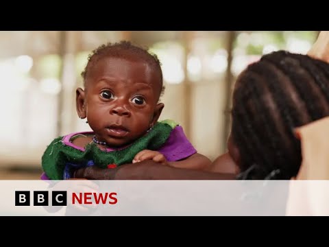 Nigeria: Millions of children face acute hunger | BBC News