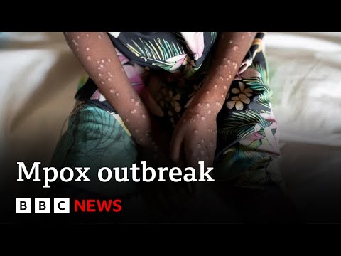 What is mpox and how is it spread? | BBC News