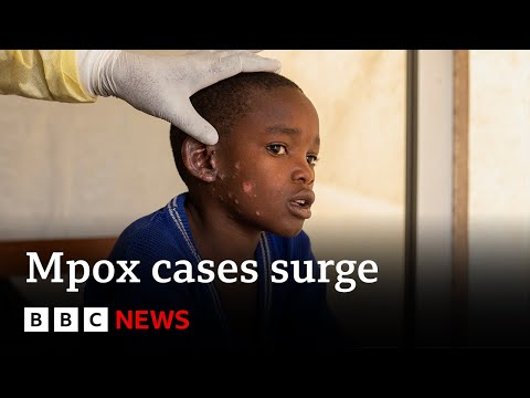 Mpox vaccinations are set to begin as cases surge | BBC News