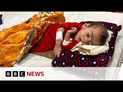 Afghanistan hospital struggling to save starving babies  | BBC News